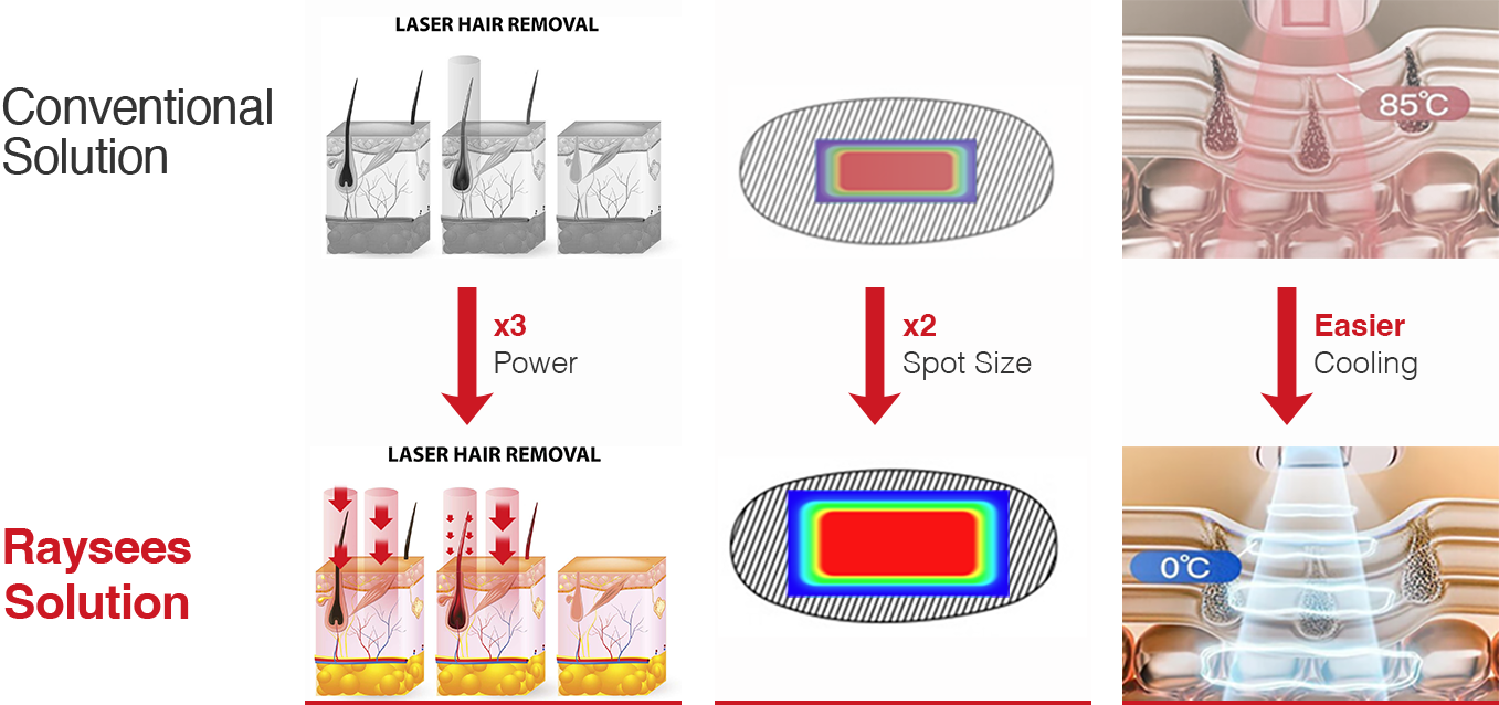 D3 Laser Hair Removal Solution.png