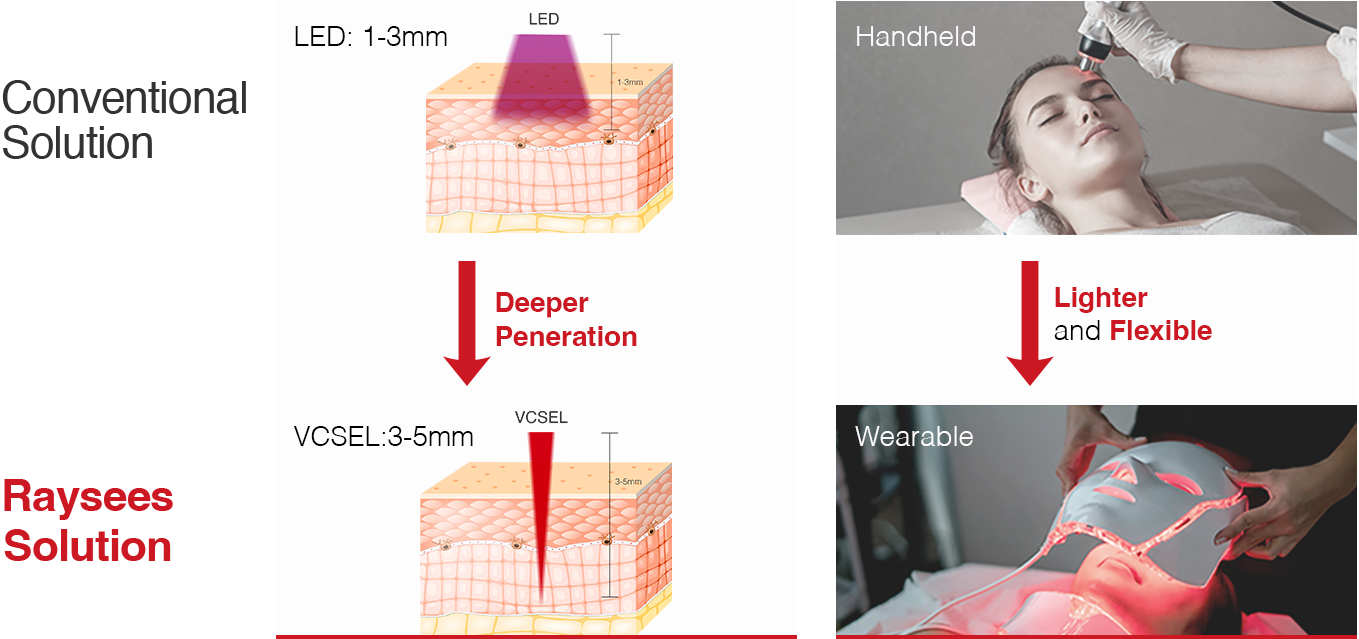 D4 Laser Face Mask Solution.png